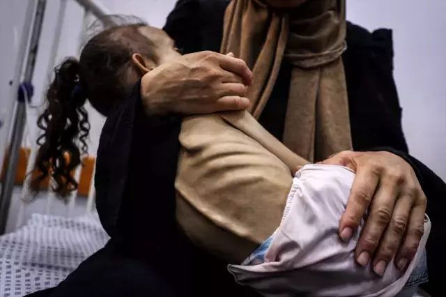 İnsanlığı utandıracak görüntüler! Gazzeli Meryem yavaş yavaş ölüyor