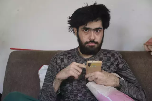 3 yıldır tırnaklarını kesmeyen ve duş almayan gencin eski hali ortaya çıktı