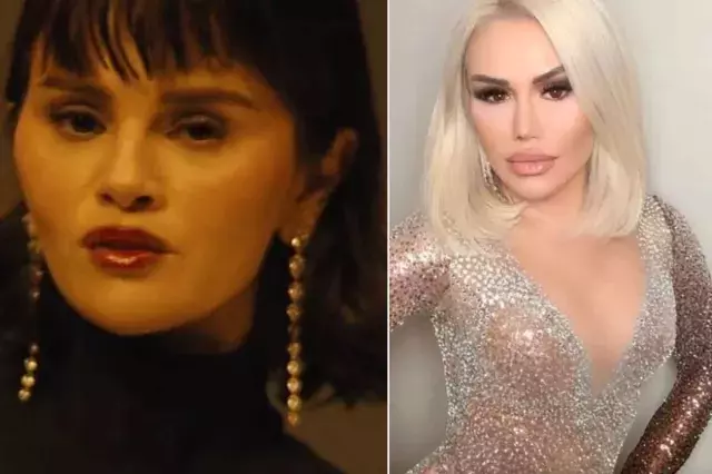 Estetiği abartan Selena Gomez'in son hali türkücü Ceylan'a benzetildi