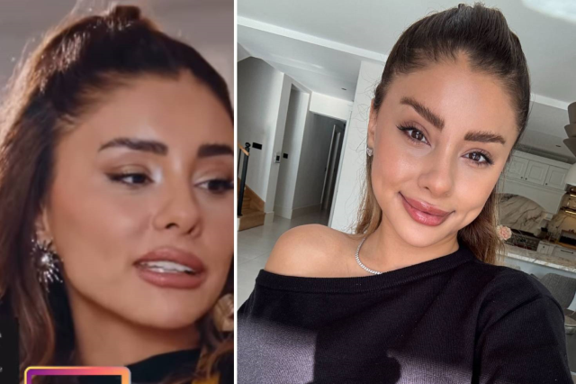 'Ağzı yamulmuş' denilen Samar Dadgar iddialara yanıt verdi ve sebebini açıkladı