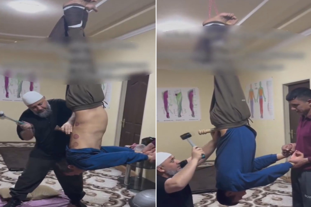 Tedavi değil işkence! Ayaklarından tavana asıp çekiç ve kazıkla...