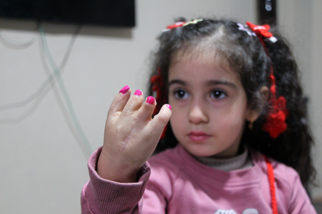 Yapışık parmakla doğan Elif'in tedavisi babasının işten çıkarılmasıyla yarım kaldı