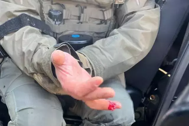 ICE karşıtı protestolarda şoke eden olay: Görevlinin parmağını ısırarak kopardılar