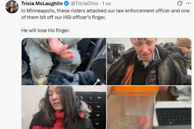 ICE karşıtı protestolarda şoke eden olay: Görevlinin parmağını ısırarak kopardılar