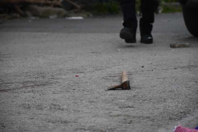 Polise baltayla saldıran şüpheli, bacağından vuruldu