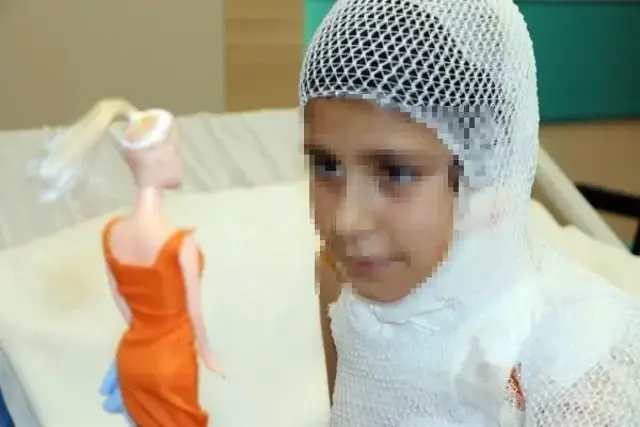 Sosyal medya trendini deneyen çocuk ağır yaralandı