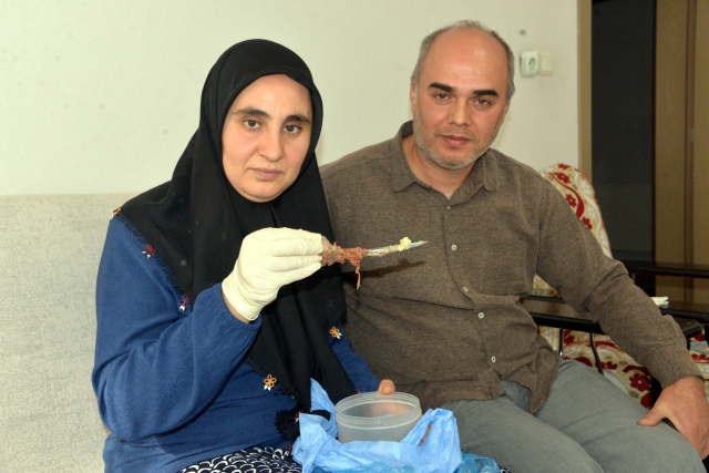 Baş ağrısı şikayetiyle gitti, karnından 16 cm uzunluğunda makas çıktı