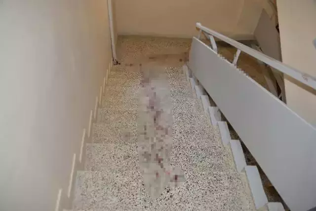 Epilasyon merkezindeki olayın kan donduran detayları! Eşini kıskanan adamı kasığından vurmuş