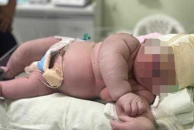 7 kilogram dünyaya gelen bebek doktorları bile şaşırttı! Yarım metreden fazla da boyu var