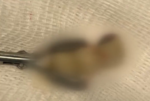 Sabah uyandığında dişleri yoktu! Doktorları bile şaşırtan gerçek hastaneye ortaya çıktı