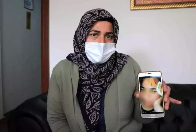 3 buçuk aylık hamileyken üst komşusunun saldırısına uğradı: Yüzüme tencereyle vurdu, kafamda poşet parçaladı