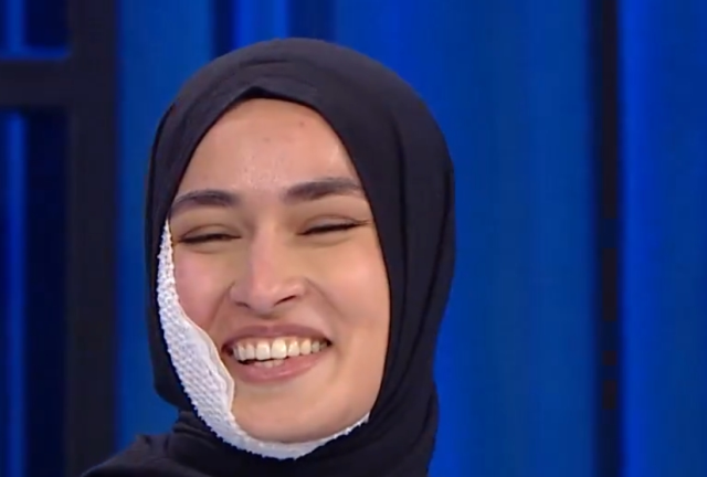 MasterChef Beyza yüzünde iz kalacak mı, son hali nasıl?