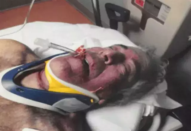 Bu kişi Epstein değil mi? Hastane fotoğrafında çarpıcı detay