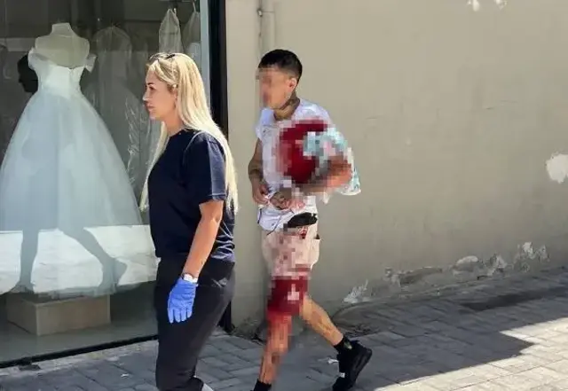 Kıskançlık krizine giren eski sevgili, evdeki tamirciyi bıçakladı