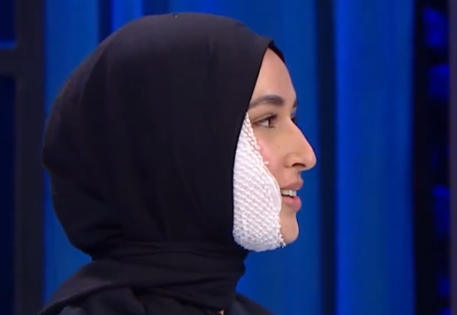 MasterChef Beyza yüzünde iz kalacak mı, son hali nasıl?