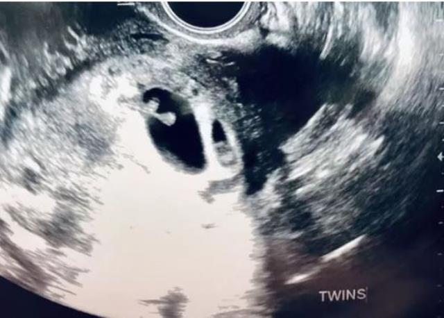 Hamileyken kocasıyla cinsel ilişkiye giren kadın, şok gerçeği doktora gittiğinde öğrendi