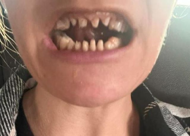 Danimarkalı kız kardeşler İstanbul'da Suriyelilere ait kaçak diş merkezinde ameliyat oldu! Sonrası kabus