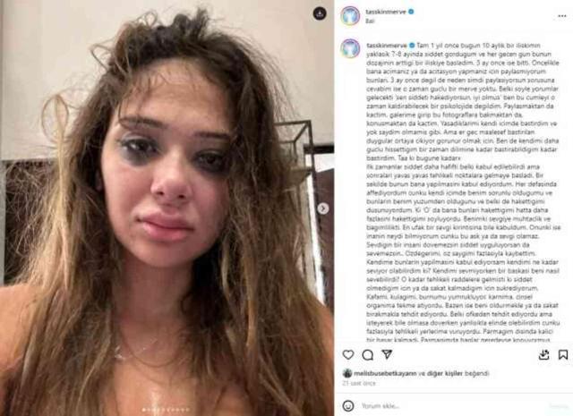 Fenomen Merve Taşkın, eski sevgilisi tarafından öldüresiye dövüldü: Cinsel organımı tekmeliyordu