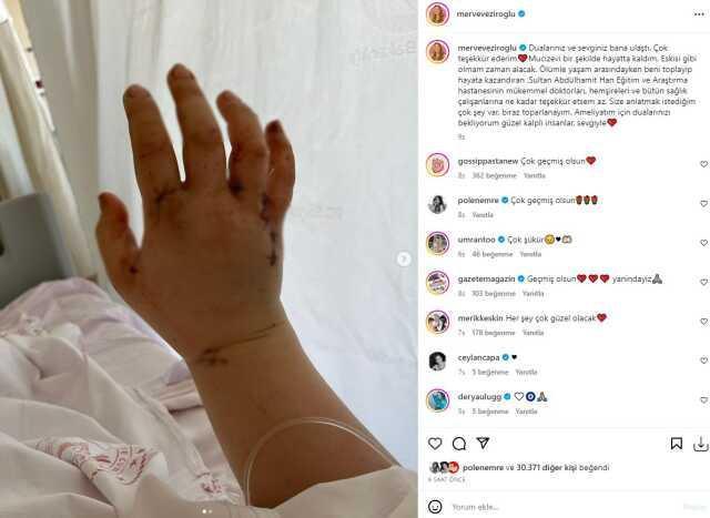 Youtuber Merve Veziroğlu'nun sağlık durumu nasıl? Eşi tarafından bıçaklanan Youtuber'ın sor durumu nedir?