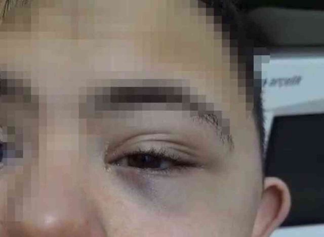 Down sendromlu çocuğa öldüresiye dayak! Yalanı güvenlik kamerası görüntüleri ortaya çıkardı