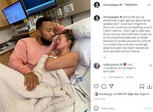 Chrissy Teigen, hayatın kaybeden bebeğini ölüm yıldönümünde andı: En büyük acıyı verdin