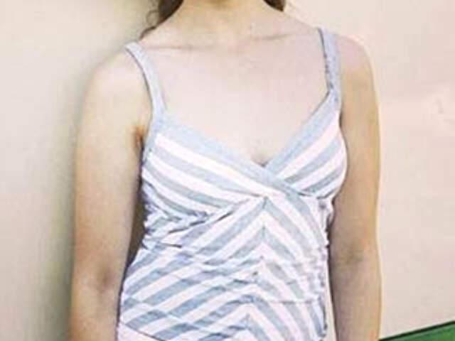 Meryem Uzerli Estetikler Sonrası Bambaşka Biri Oldu! Eski Halinden Eser Yok