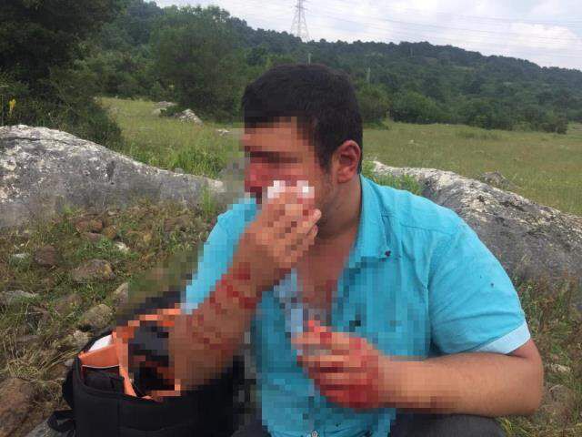 Lütfü Türkkan'ın kaçak çiftliğin yıkımını görüntüleyen muhabir darbedildi