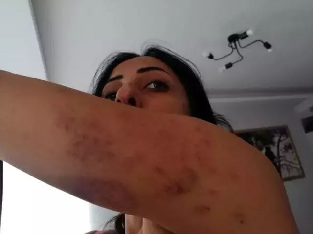 Öz annesi tarafından parayla satıldı, eşinden şiddet gördü! Saime'den yardım çığlığı