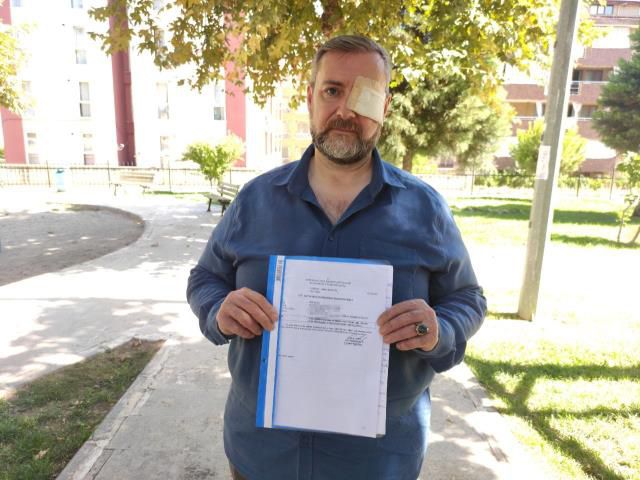 Ünlü döner zincirinin şefi, tarihi geçmiş eti satmadı diye kör edildi