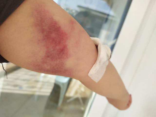 Hem sevgilisini darp etti, hem manevi tazminat davası açtı