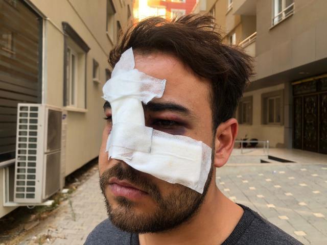 Sokak sanatçısının yüzünde şişe kırıp pişkince 'Biz sana mı vurduk' diye sormuşlar