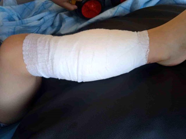 Zonguldak'da pitpull terörü! 5 yaşındaki çocuk ve annesi hastanelik oldu