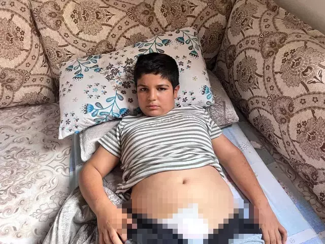 Yine başıboş sokak köpeği terörü! Saldırdıkları çocuğun kasığına, bisikletin demiri saplandı