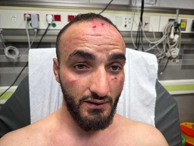 İsrail polisi, Mescidi Aksa'da çekim yapan AA foto muhabirini öldüresiye dövdü