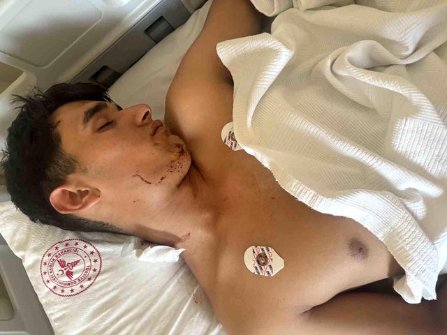 17 yaşındaki genç dondurma almaya giderken ölüyordu! Boynundan giren kurşun çenesine saplandı