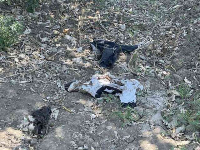 6 sokak köpeğinin saldırısında ağır yaralanan Abbas'ın babasından 'Hayvanları toplatın' çağrısı