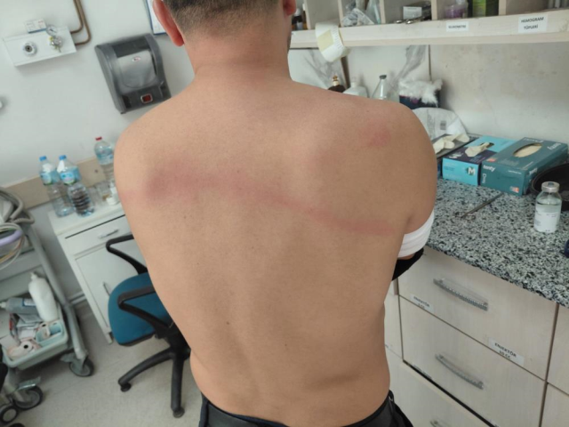 CHP'li Belediye Başkanı taş döşemek istemeyen zabıtaları sopayla dövdü