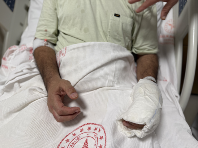 Herkesin evinde bulunan tehlike! Vücudunun yüzde 30'u yandı