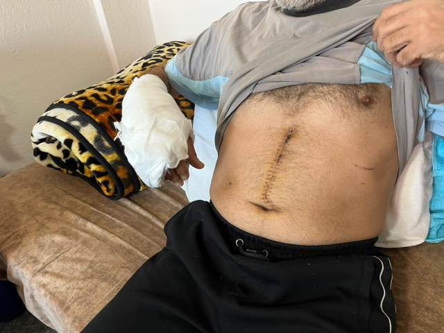 Almanya'dan cinayet işlemeye gelmiş! 3 kuruş için ablasını katletti