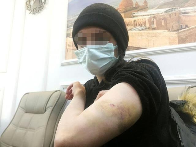 Rezidansta genç kıza işkence! İddianame hazırlandı istenen cezalar belli oldu