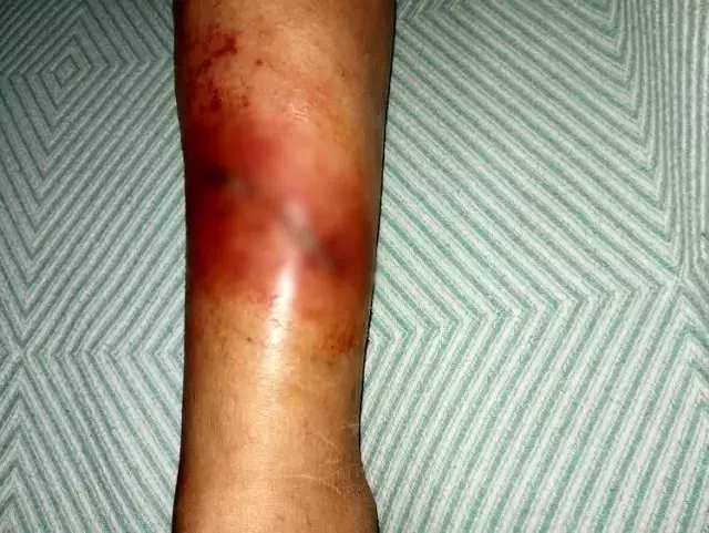 Sokak köpeklerinin saldırısına uğrayan kadın yaralandı