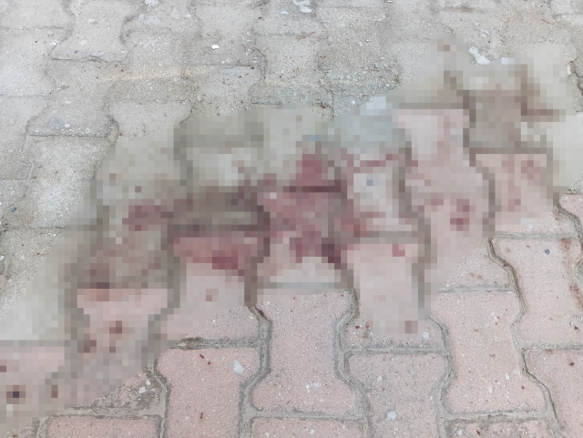 Anahtarını unutunca akılalmaz yönteme başvurdu, hastanede yaşam savaşı veriyor
