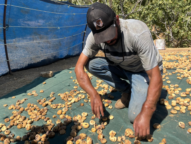 Türkiye'de bu ameliyat ilk kez yapıldı! 44 yaşında yeniden hayata tutundu