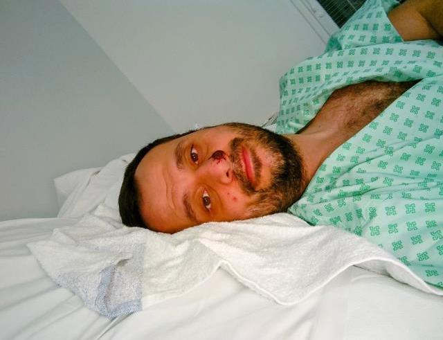 Maymun çiçeğine yakalanan Türk vatandaşı konuştu: Öleceğimi sandım