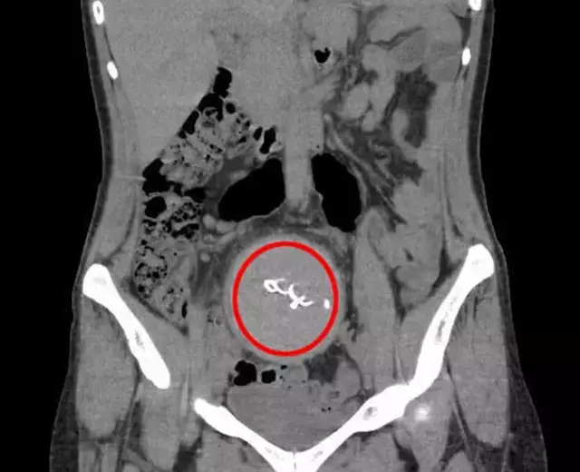 Doğumdan sonra hayatı karardı, sebebi 2 yıl sonra ortaya çıktı