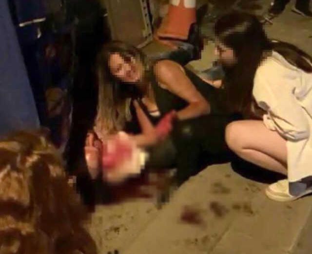 'İstek parça' cinayetinde öldürülen müzisyenin yaralı haldeki görüntüsü dava dosyasında