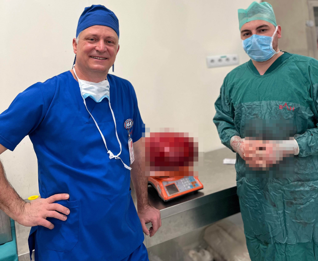 Görenler kilo aldı sandı, karnından 30 santim uzunluğunda 10,5 kiloluk kitle çıktı