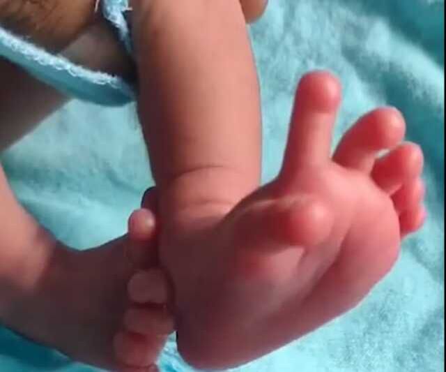 Hindistan'da Bharatpur şehrinde 26 parmakla dünyaya gelen bebek tanrıça olarak görülüyor