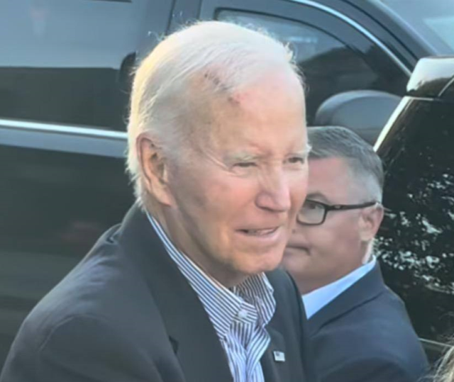 Eski ABD Başkanı Joe Biden cilt kanseri ameliyatı oldu