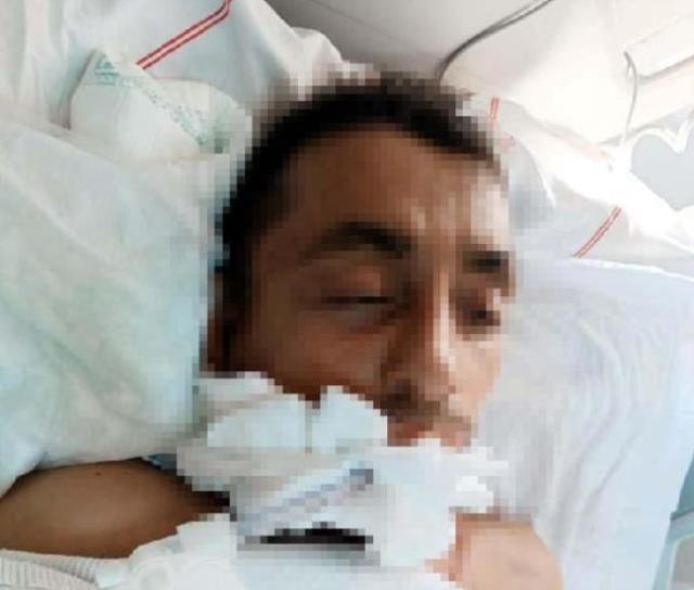 Sedyeden düşüp beyin kanaması geçiren diyaliz hastası, 8 gün sonra öldü